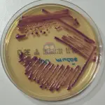 Escherichia coli auf CPSE Agar