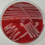Staphylococcus aureus auf Blutagar