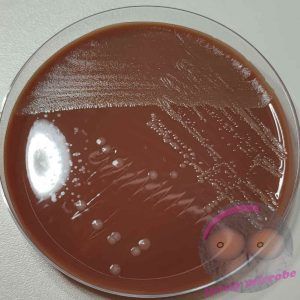 Haemophilus influenzae auf HAEM Agar