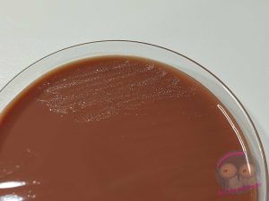 Neisseria gonorrhoeae auf VCA3 Agar