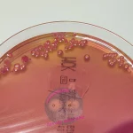 Klebsiella auf MCK Agar