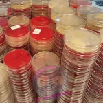 Agar Platten im Labor