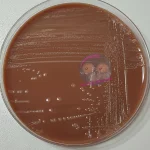 Actinobacillus pleuropneumoniae auf PVX Agar