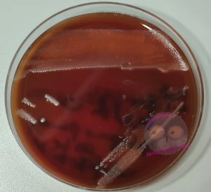 Cardiobacterium hominis auf Columbia Agar
