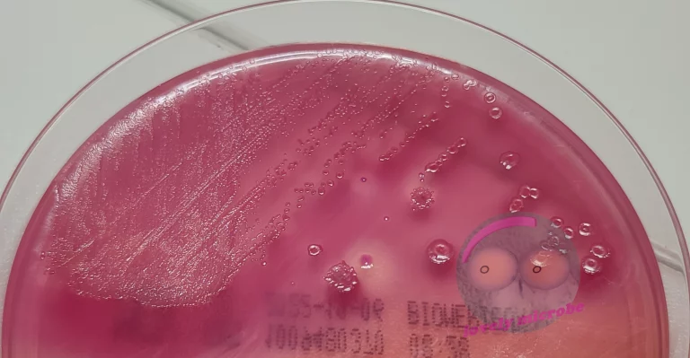 Escherichia coli auf MCK Agar, Lactose positiv