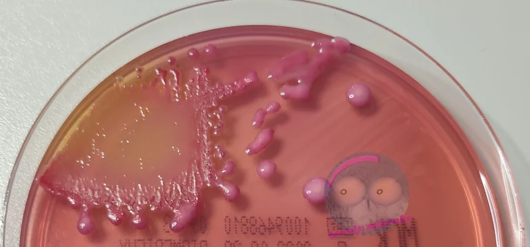 Klebsiella oxytoka auf MCK Agar, Lactose positiv, schleimige Kolonien