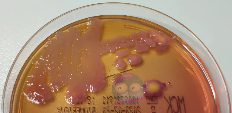 Klebsiella pneumoniae auf MCK Agar, Lactose positiv, schleimige Kolonien