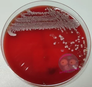 Moraxella catarrhalis auf Columbia Agar