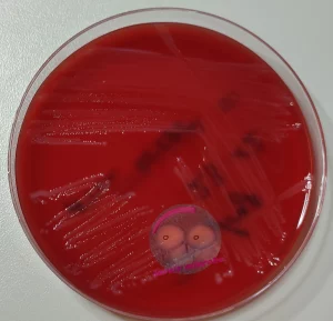 Bacteroides fragilis auf Columbia Agar