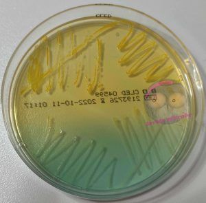 Enterococcus faecalis und Streptococcus agalactiae auf CLED Agar