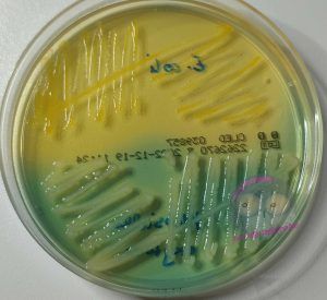 Escherichia coli und Klebsiella oxytoca auf CLED Agar