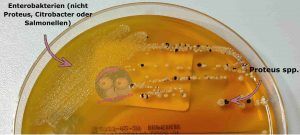 Enterobakterien und Proteus auf XLD Agar