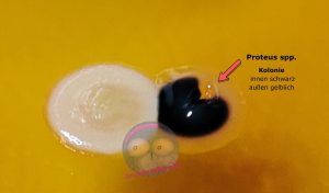 Makroaufnahme von Proteus spp auf XLD Agar