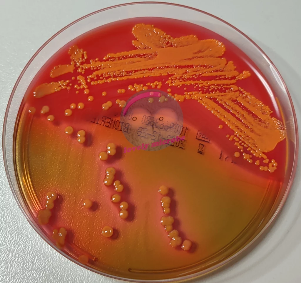 Enterobakterien auf Hektoen Agar