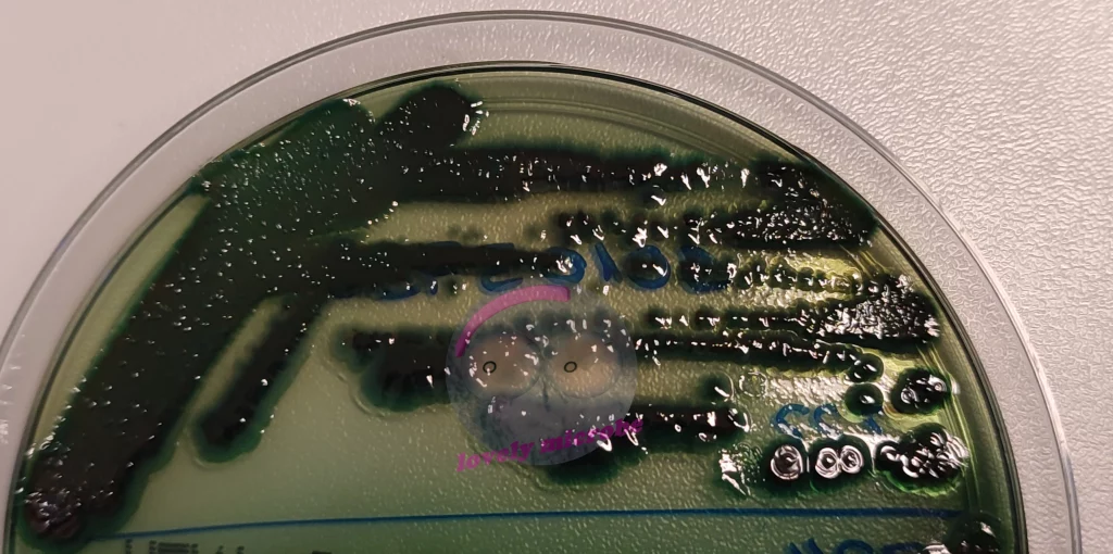Salmonella spp Mischflora auf Hektoen Agar