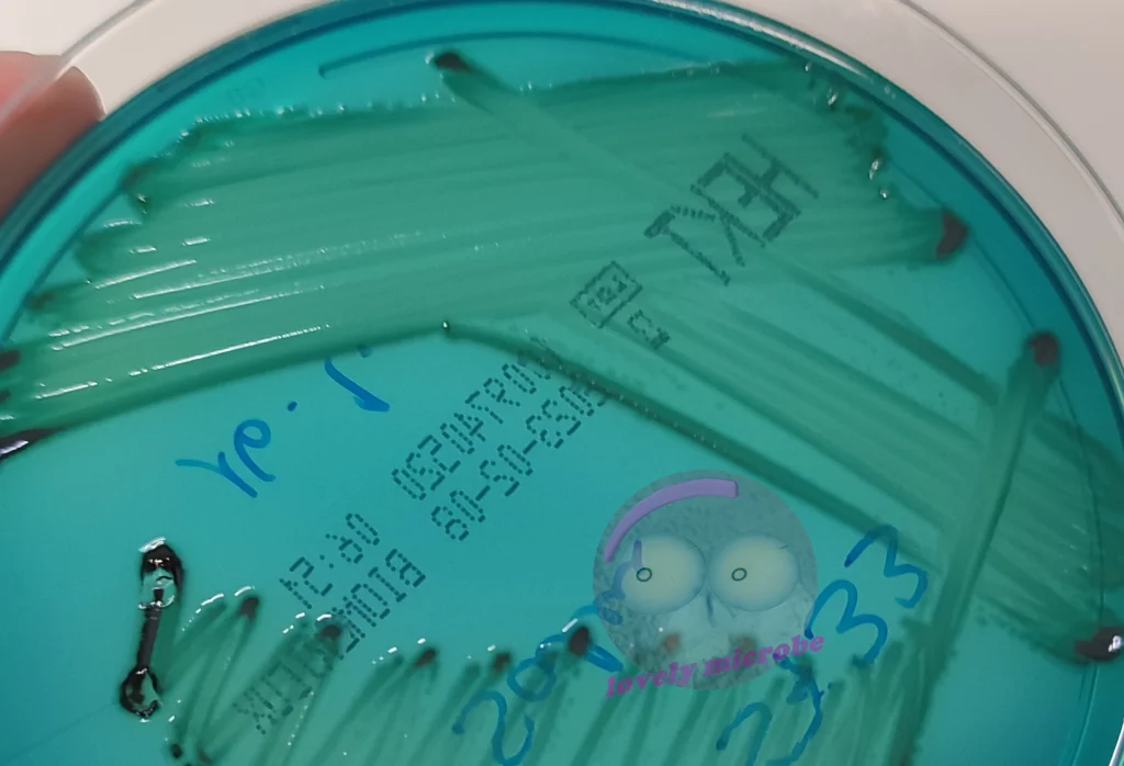 Salmonella spp. auf Hektoen Agar