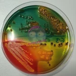 Stuhlflora auf Hektoen Agar
