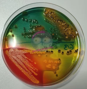 Stuhlflora auf Hektoen Agar