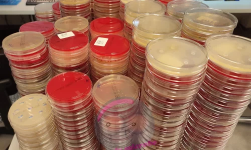 platten labor Agar Platten im Labor